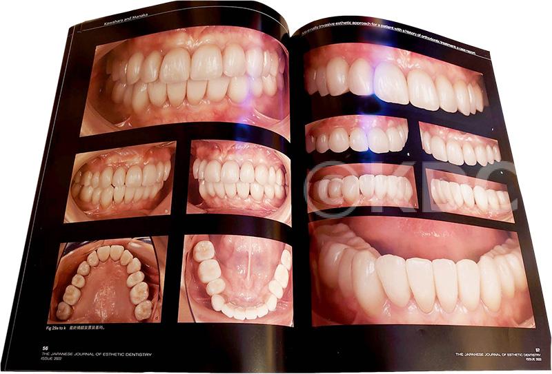 ODT別冊2022　歯科医師および技工士を対象とした雑誌