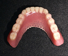10年経過した総義歯の症例：下顎