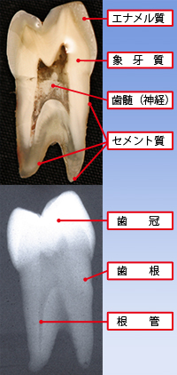 歯牙標本